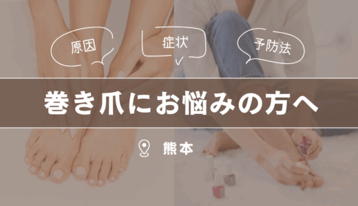 熊本で巻き爪にお悩みの方へ｜原因・症状・予防法を徹底解説