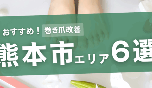 【熊本市エリア】巻き爪改善で通いたいおすすめサロン6選