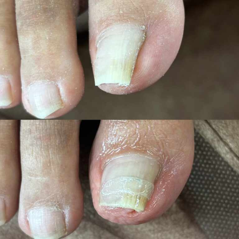 右親指