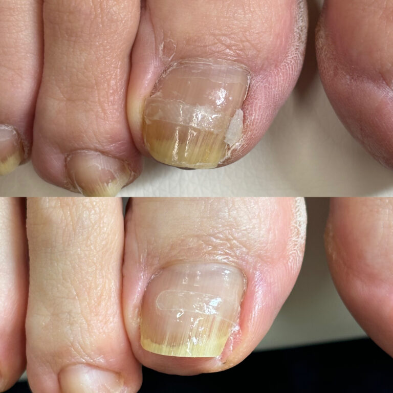 左右親指