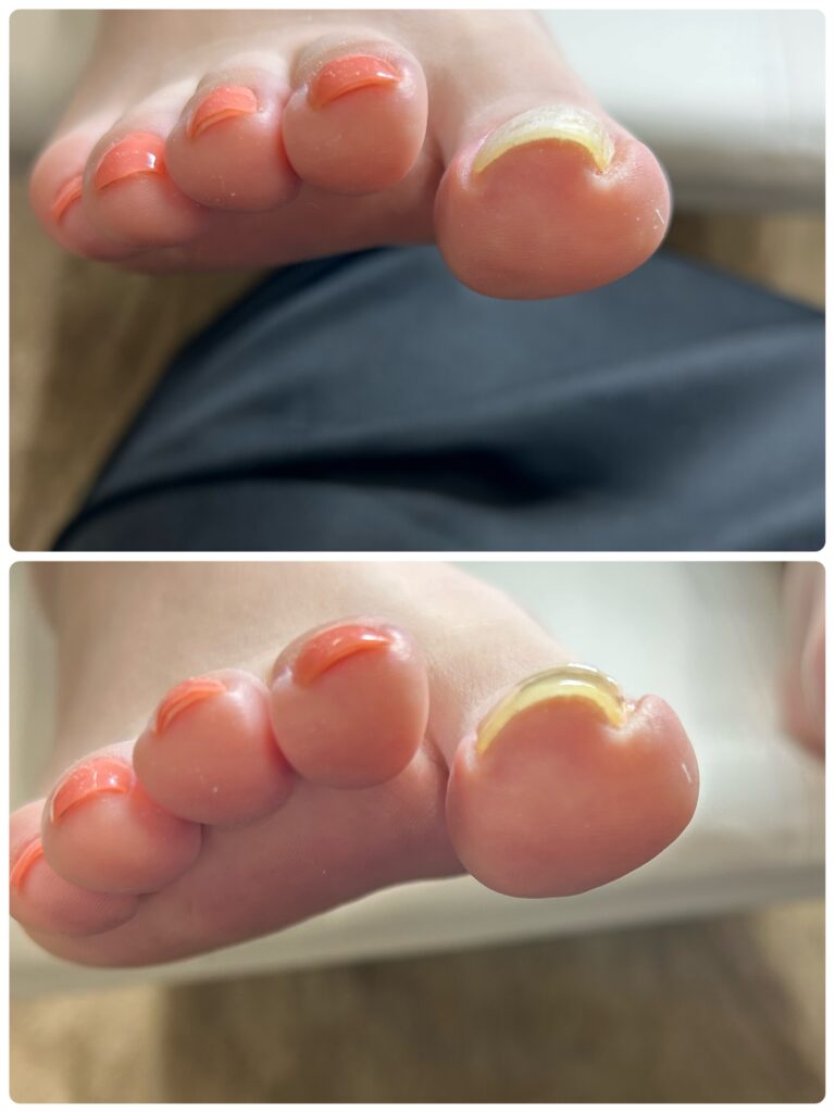 右親指