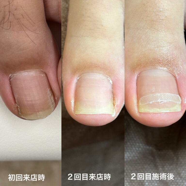 右親指