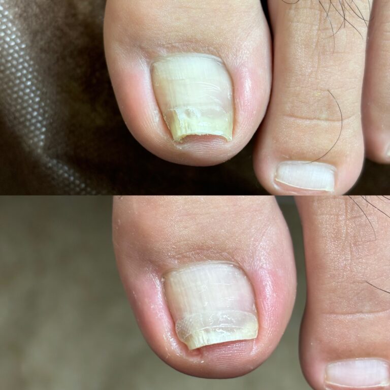 両親指